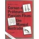 Coroas e Proteses Parciais Fixas - um Manual Ilustrativo-D. N. Allan / P. C. Foreman